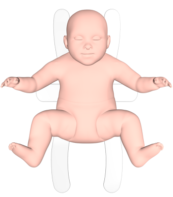 Coxa-Splint: 3D preview #1 | Pedihealth Oy